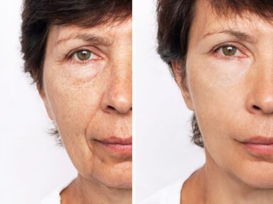 Routine beauté quotidienne : prévenir la chute de cheveux et les signes de l’âge